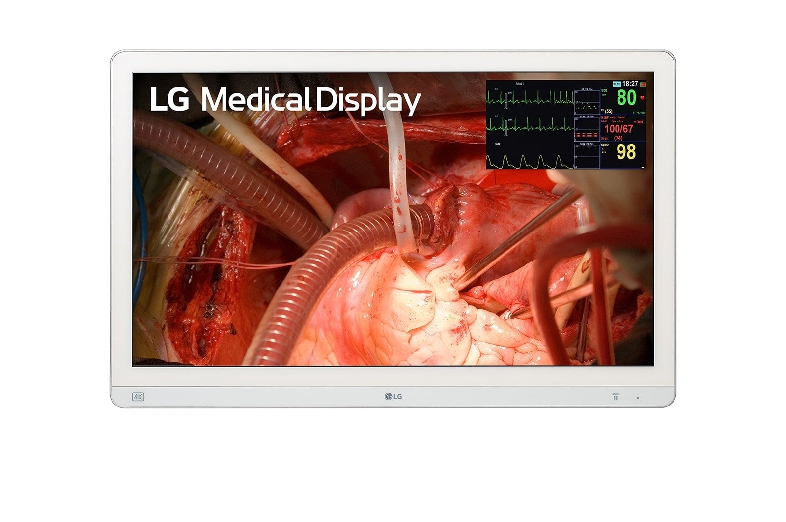 LG 27HQ710S-W broadcast monitor 68.6 cm (27")