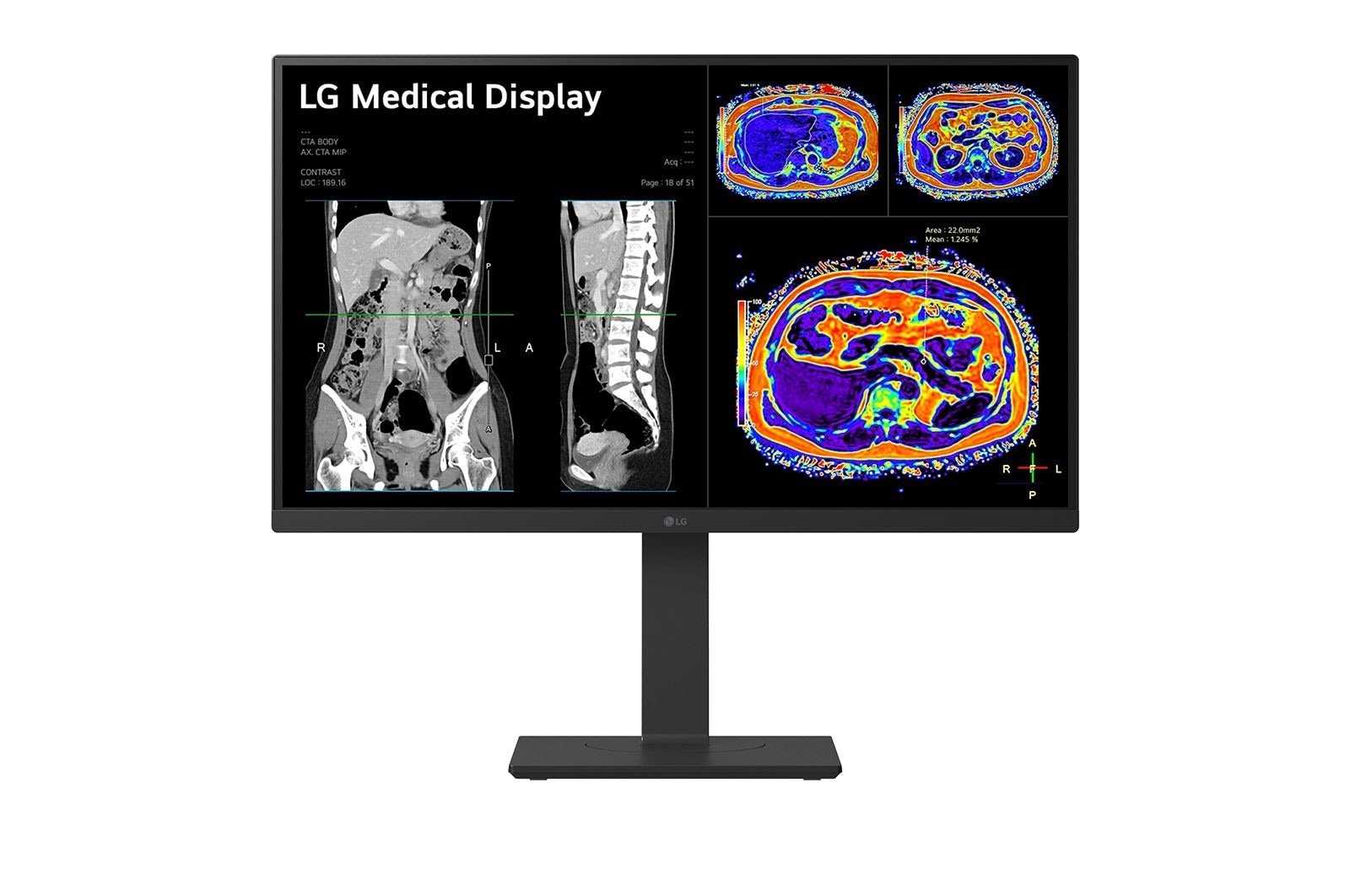 LG 27HS713C-B computer monitor 68.6 cm (27") 3840 x 2160 pixels 4K Ultra HD LED Black